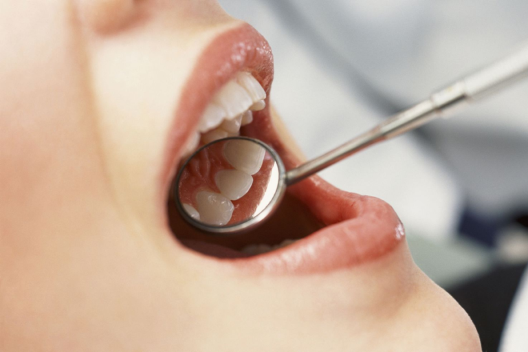 8 Oral Health Issues That Require Immediate Treatment